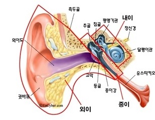 중이염_증상2.jpg