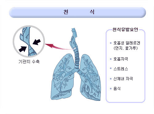 한쪽귀가_멍멍해요_왜그런걸까요.jpg