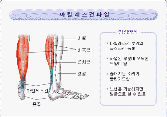 크기변환_10.gif